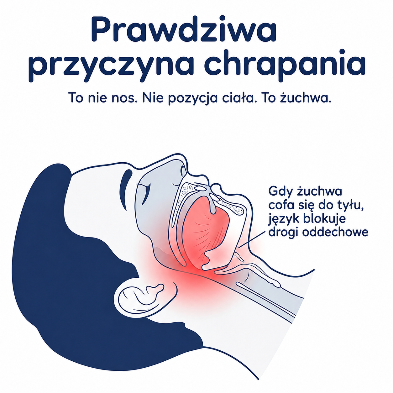 Pozbądź się chrapania już od pierwszej nocy – SomnoLab (+ HIGIENICZNE ETUI OCHRONNE GRATIS)